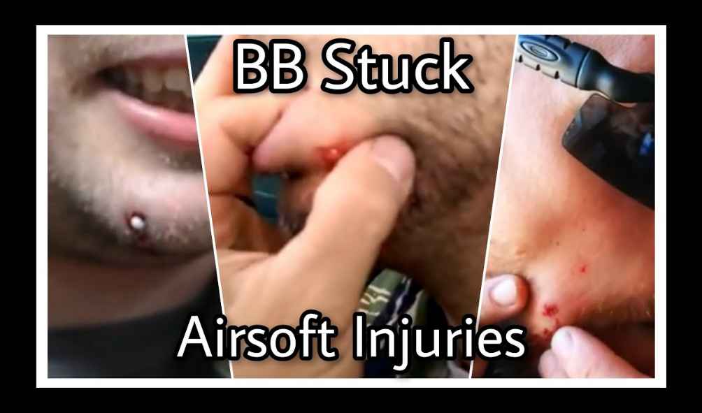 Airsoft injury